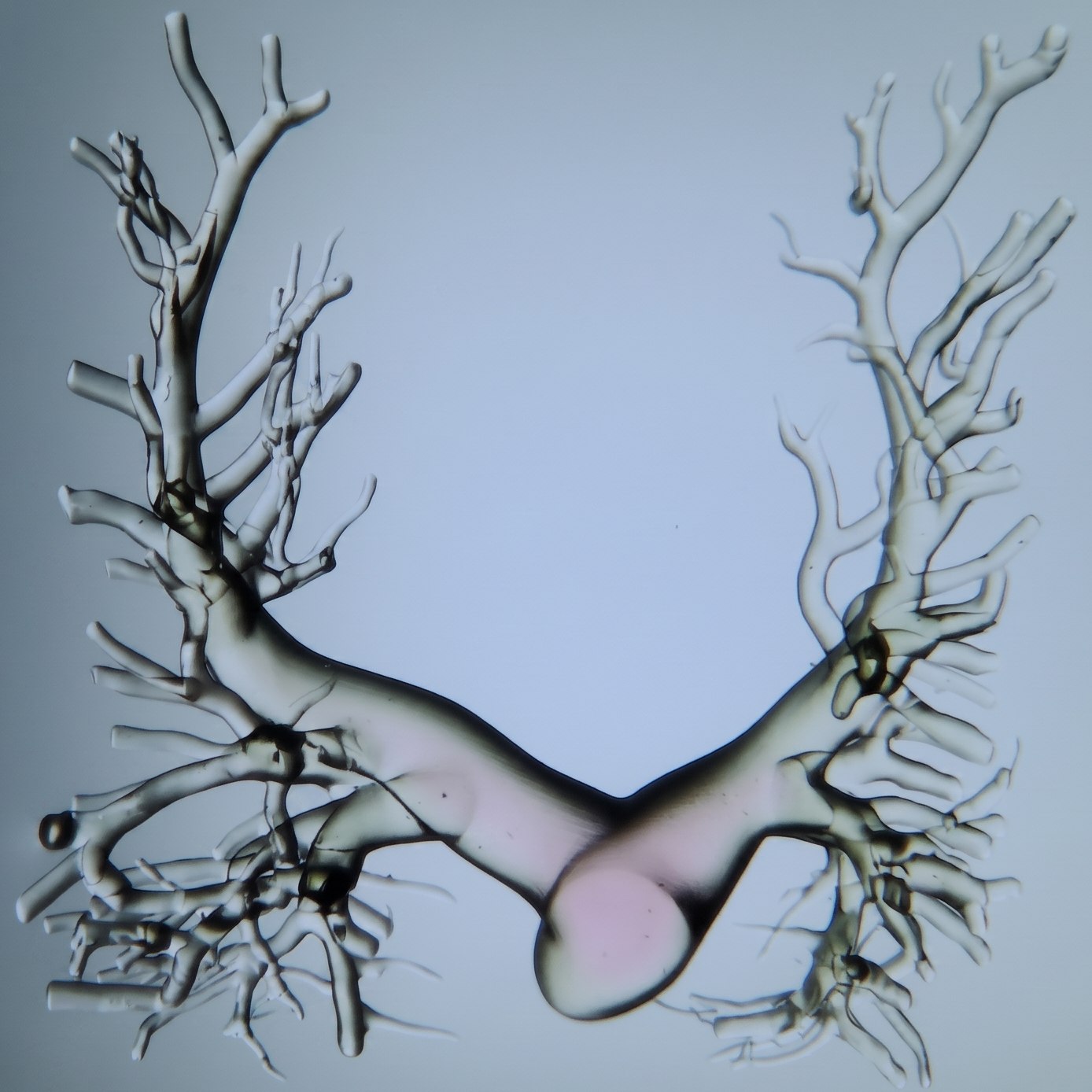 Branching vascular tree structure printed in a GelMA/PEGDA copolymer
